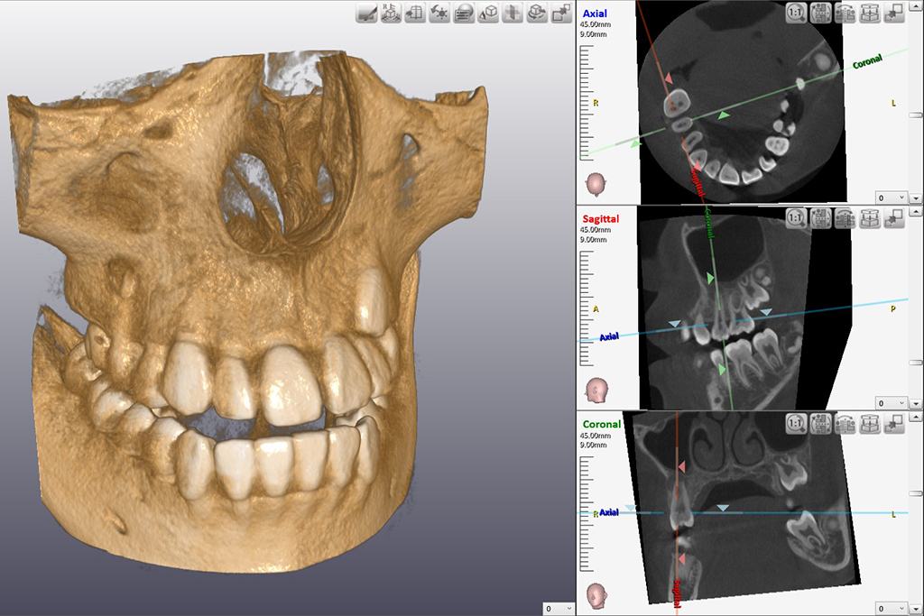 名古屋市西区・はせがわ歯科